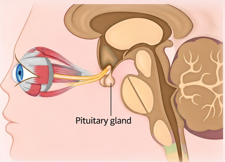 Anatomical illustration: the optic nerve running from the back of the eye to the pituitary gland at the base of the brain